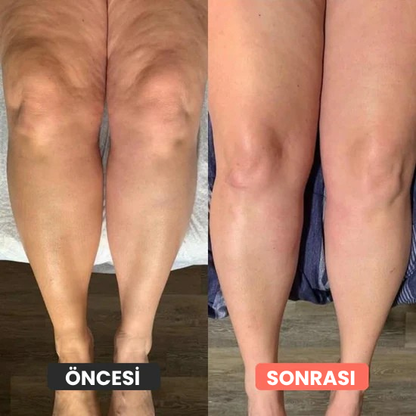 Thermoslim Vücut Şekillendirici