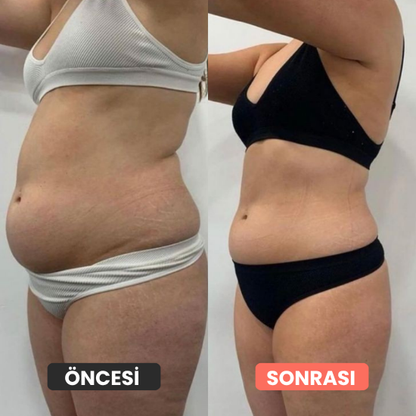 Thermoslim Vücut Şekillendirici