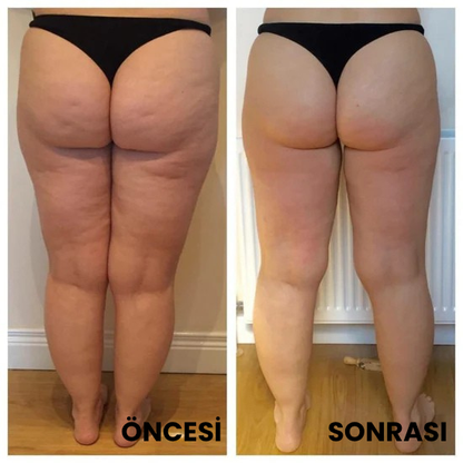 Thermoslim Vücut Şekillendirici